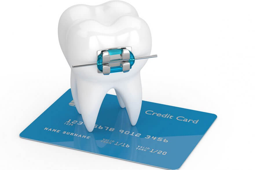 How Much Do Braces Cost?, 5 Factors to Consider